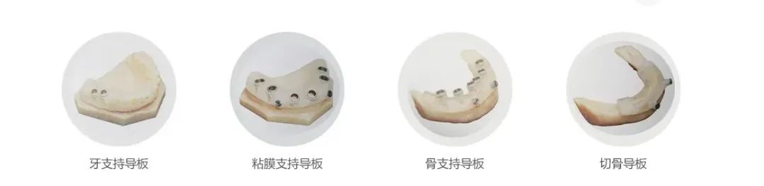 精藝全瓷.jpg